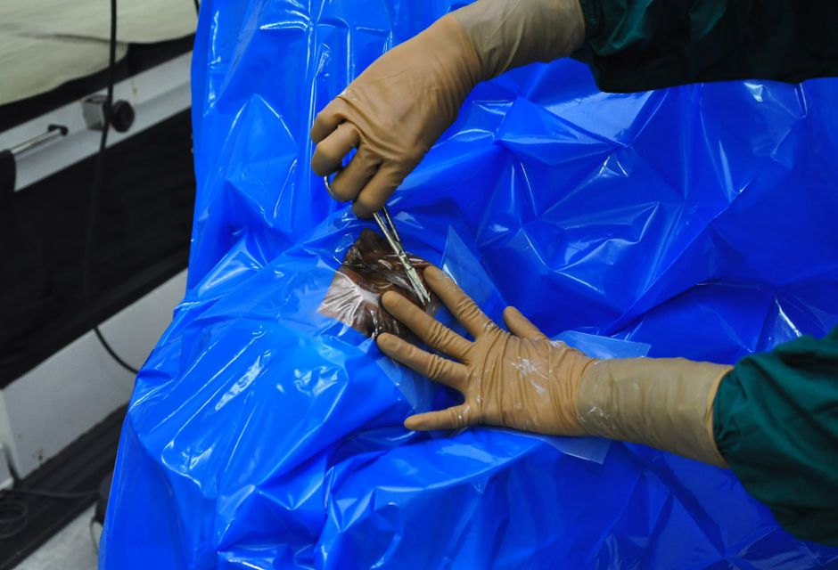 Eye Draping for Surgery