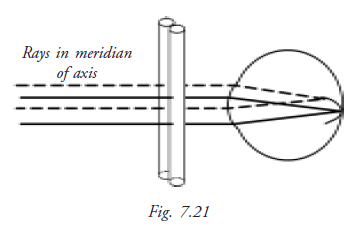  Function of maddox Rod